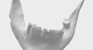 Lisansüstü Öğrencimiz Hilal Selamet, Biyomalzeme Uygulama ve Araştırma Merkezimizde bir alt çene üretti